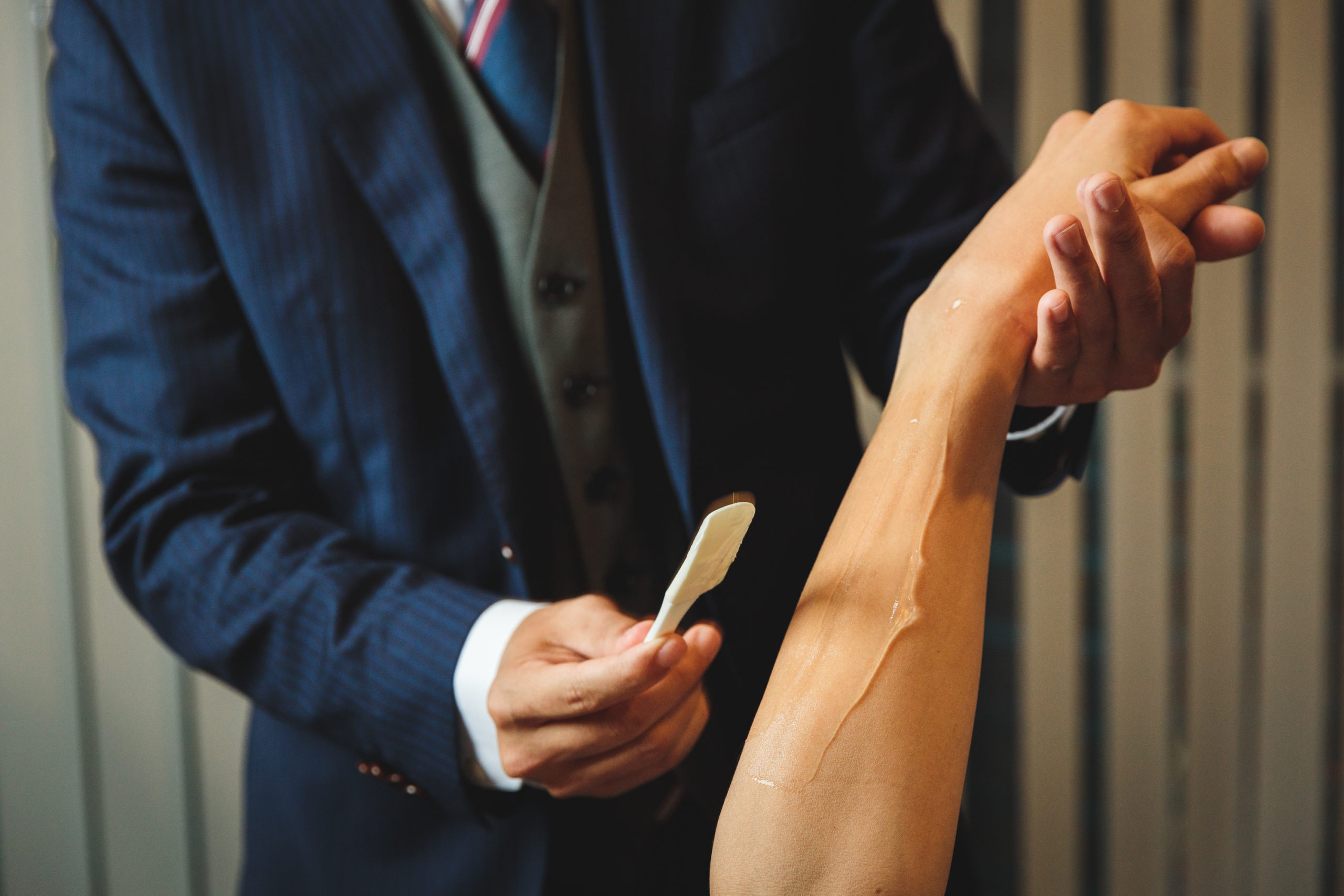 男性の腕毛は気になる？剃る注意点やサロンで脱毛するメリットを解説！