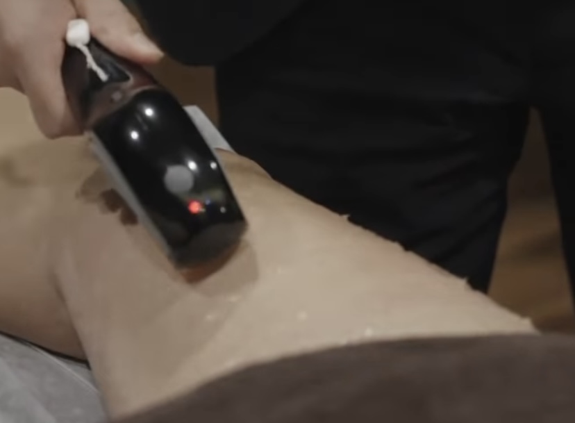 膝の脱毛は抜けない?抜けにくい理由やおすすめの脱毛方法を解説!