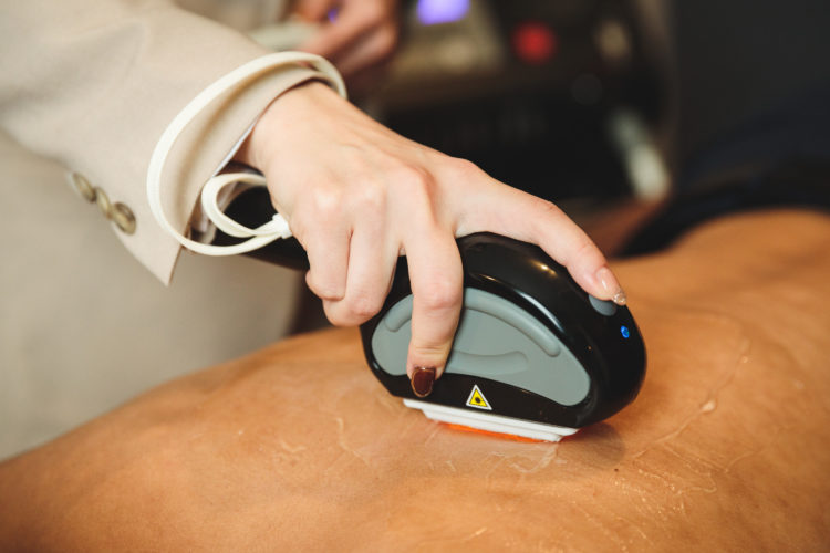 メンズ全身脱毛