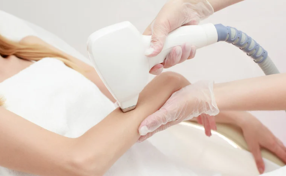 脱毛は5回じゃ足りない？人によって回数がバラバラな理由